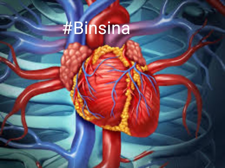 HEART SURGERY WITH BINSINA