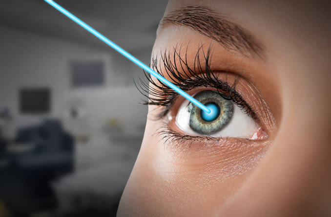 LASIK Laser Eye Surgery