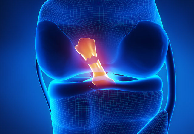 Knee Ligaments Repair Surgery